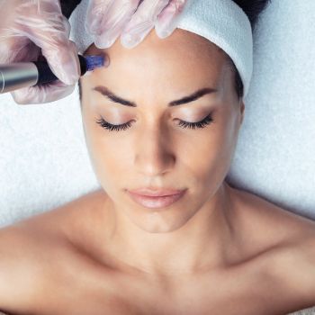 microneedling on long island