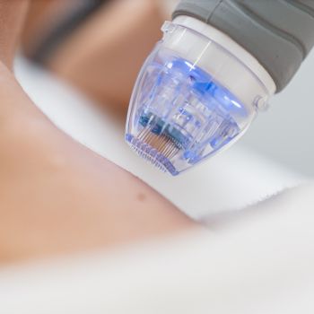 Microneedling On Long Island