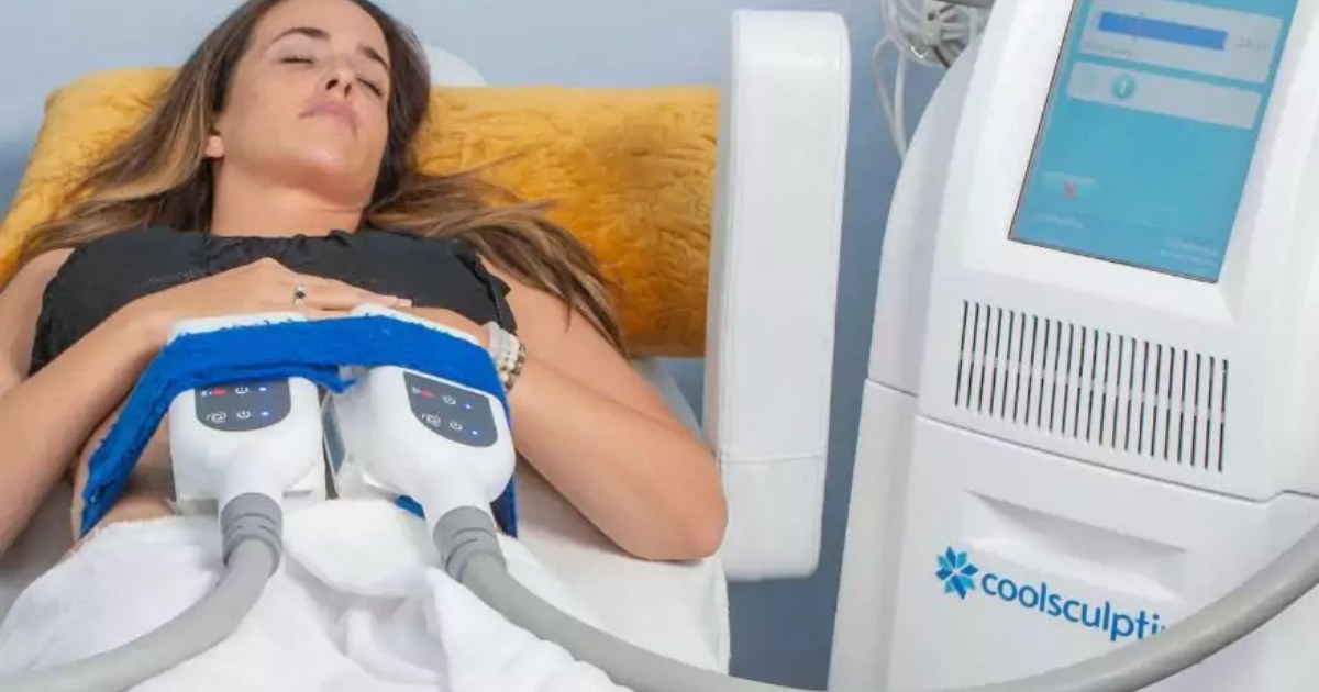 woman getting CoolSculpting